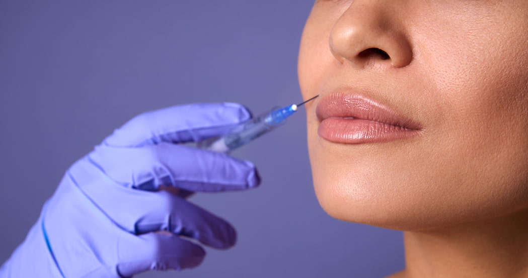 Juvederm Lip Injections