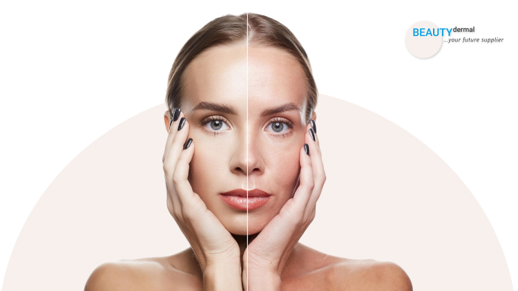 full face botox before and after