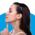 pdo thread lift eyes